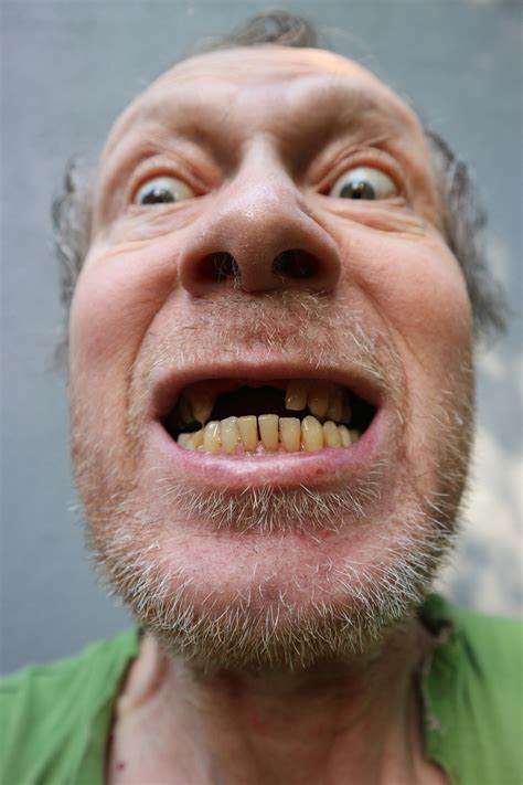 Missing Teeth Free Stock Photo - Public Domain Pictures