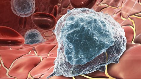 Beets, blackberries and rhubarb can turn urine red or pink. Prostate Cancer Vaccine - YouTube