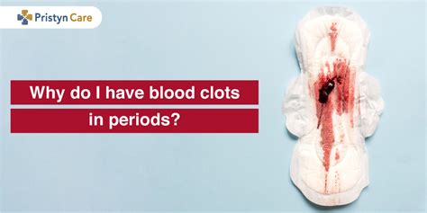 Lots Of Clots With Period