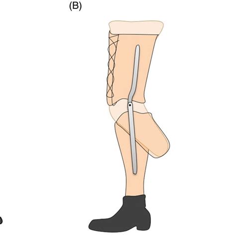 A Shows A Transtibial Amputee Sitting With A Bent Knee Prosthesis