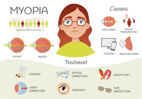 Infographics Of Myopia Review Of Myopia Management