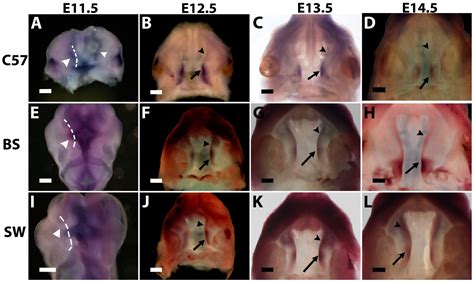 Jdb Free Full Text Strain Dependent Gene Expression During Mouse