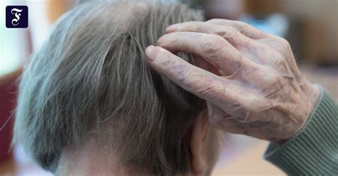 Neues Medikament Gegen Alzheimer Gibt Anlass Zur Hoffnung