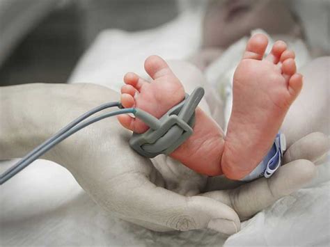Improved Survival Seen For Premature Infants Medpage Today