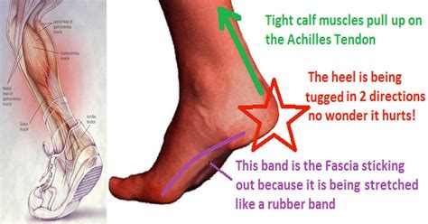 If you suffer from sore, painful calves, here are the best stretches to help you release built up tightness. This ONE Stretch Relieves Plantar Fasciitis, Shin Splints ...