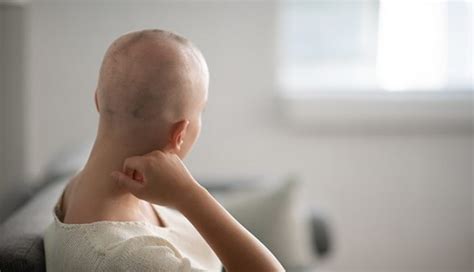 Hair Loss After Chemotherapy 10 Things To Know MD Anderson Cancer Center