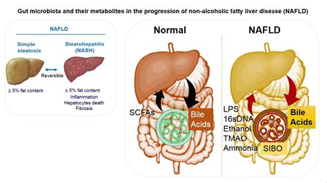 Hr Gut Microbiota And Their Metabolites In The Progression Of Non