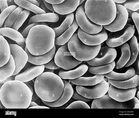 Human Red Blood Cells Rbcs Isotonic Scanning Electron Micrograph