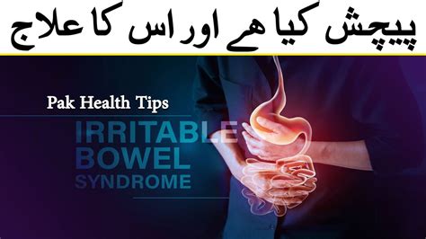 What Is Ibs Causes Symptoms And Treatments Youtube