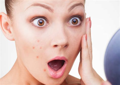 Why You Should Not Pop Pimples Fashion Technology