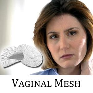 Vaginal Mesh Lawsuit Filed Against Ethicon Inc By Wright Schulte