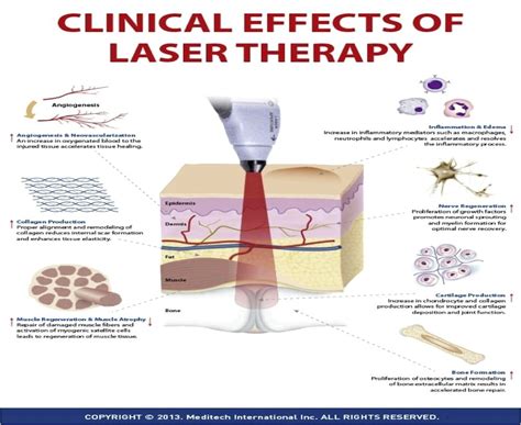 Can Laser Treatment Cause Cancer Proskin Clinics