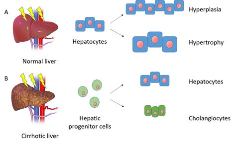 Schematic Representation Of Mechanisms Of Liver Regeneration A After