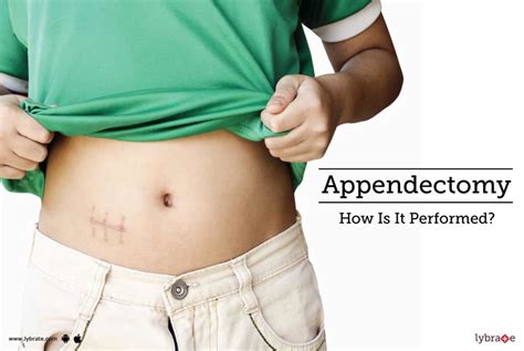 appendectomy how is it performed by dr shrikant bhoyar lybrate