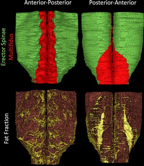 Three Dimensional Reconstructions Of Muscle Volume Top Of The Erector