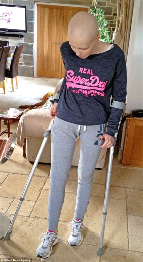 Sarah Dransfield Has Leg AMPUTATED After Leg Sprain Turned Out To Be Bone Cancer Daily Mail Online