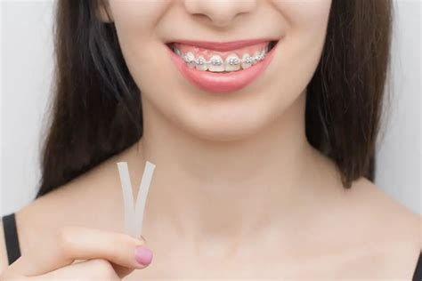 Can You Eat Braces Wax What You Need To Know If Youve Just Swallowed Some Braces Journey