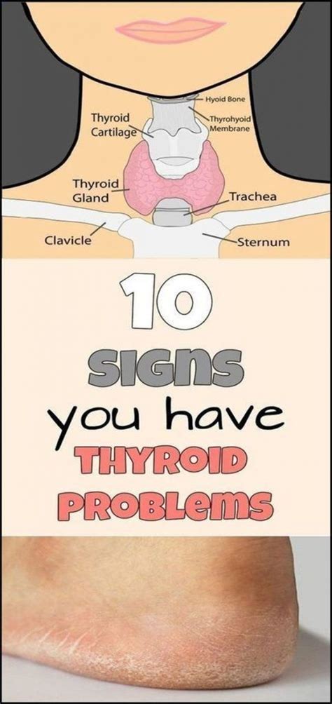 10 Signs You Have A Thyroid Problem And 10 Solutions For It Healthy