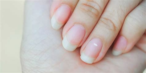 This Is What The White Nail Spots On Your Fingers Mean