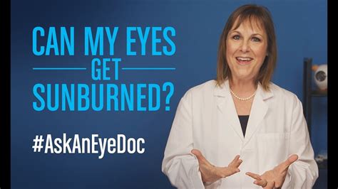 Ask An Eye Doc Can Eyes Get Sunburned Youtube