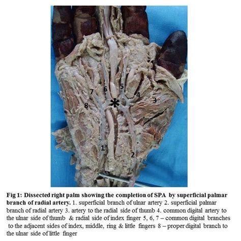 Pdf Formation Of Superficial Palmar Archa Cadaveric Study With Its