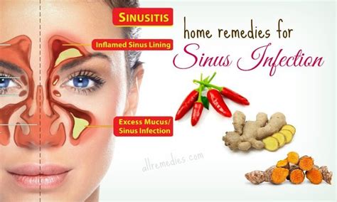 30 Best Natural Home Remedies For Sinus Infection In Adults
