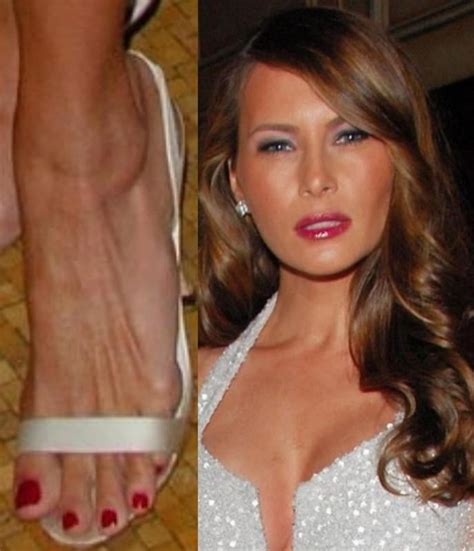 Melania Trump Sexy Leg Feet And High Heel 2195 Pics Xhamster