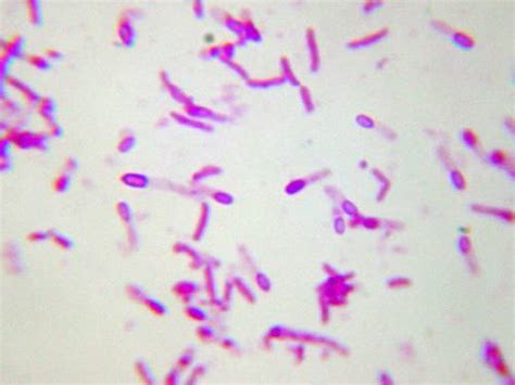 Endospore Staining Principle Procedure Results • Microbe Online