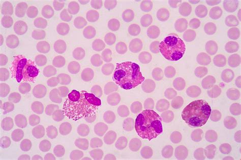 Increased Blood Eosinophils In Women And Children Causes Of
