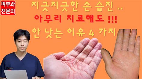 손 습진 생활 속 관리법 4 가지 By 피부과 전문의 Youtube