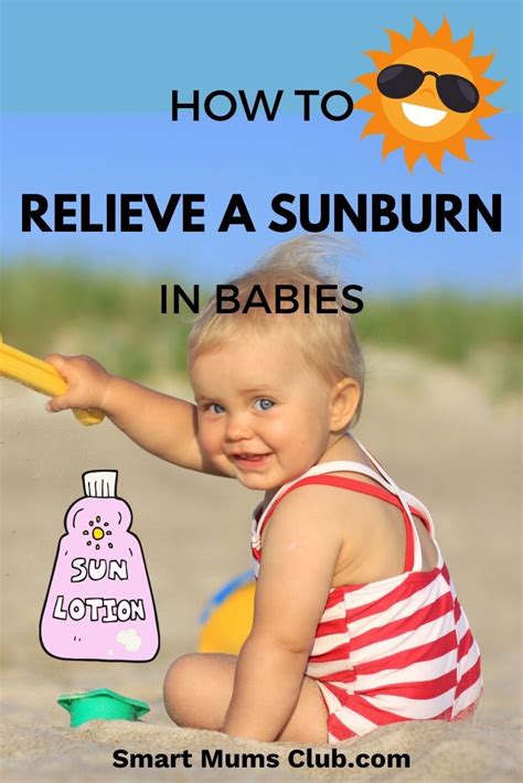 How To Relieve Sunburn In Babies Baby Sunburn Sunburn Baby Sun