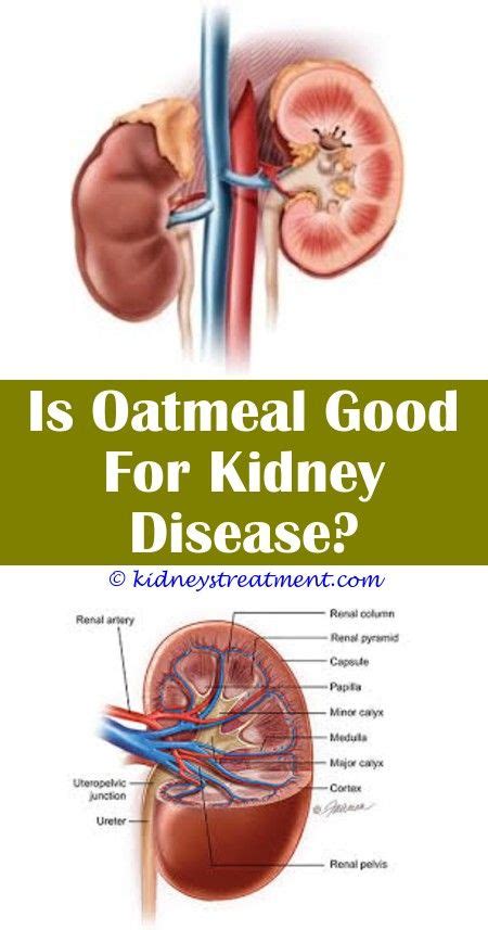 Age, deprivation and ethnic origin are all associated with relatively common conditions like diabetes. Kidney Failure Water Retention Diabetes - kidneyoi