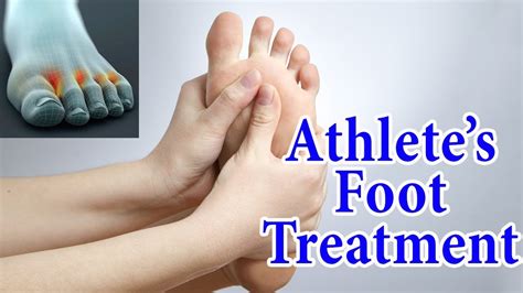 How To Get Rid Of Athletes Foot Home Remedies