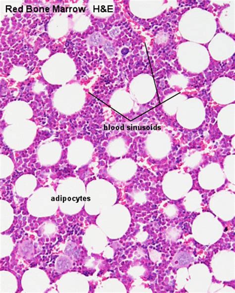 Normal Bone Marrow Histology