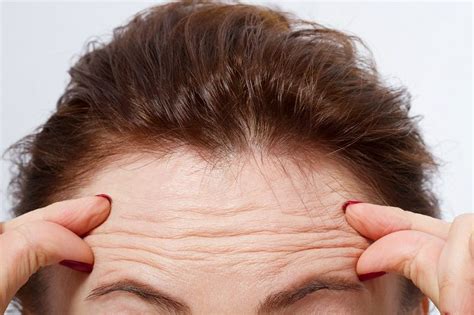 Wrinkles Causes And Treatment