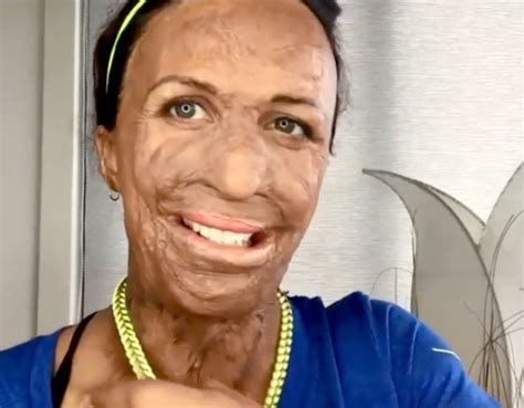 This Turia Pitt Necklace Trick Helped Her Gain Some Independence Back