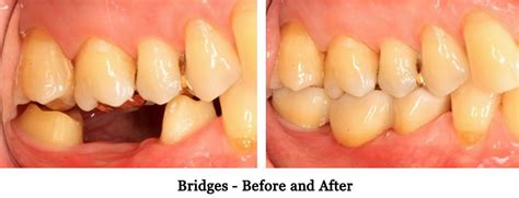 Bridges Tauranga Dental Specialists