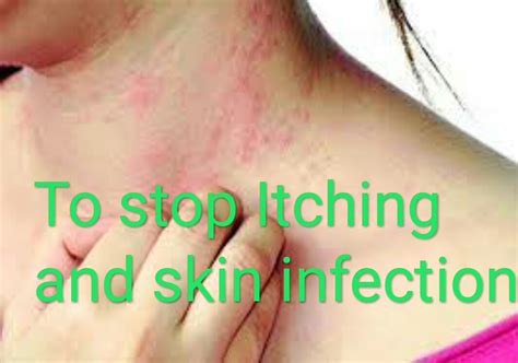 Healthcare And Health Solution Skin Infection Cause Symptoms
