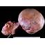Ovarian Cancer Photograph By Cnri/science Photo Library