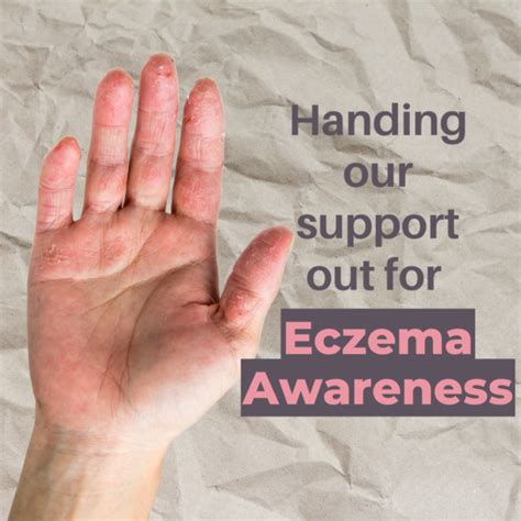 Eczema Awareness Month