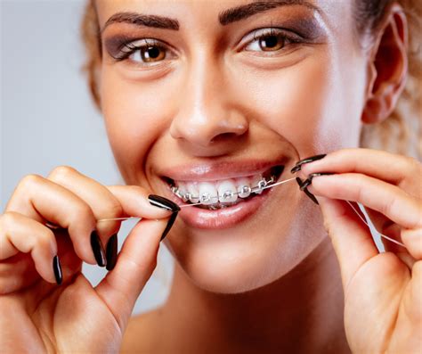 Precautions To Take With Dental Braces River Valley Smiles