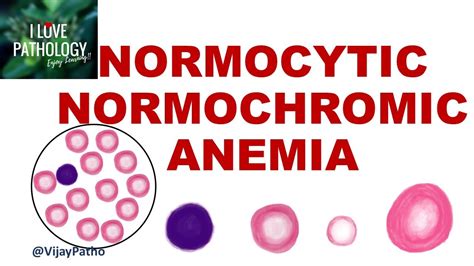 Normocytic Normochromic Anemia Causes Mechanism And Approach Youtube