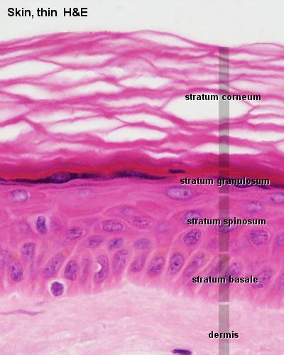 Learn about the skin's function and conditions the skin protects us from microbes and the elements, helps regulate body temperature, and permits the sensations of touch, heat, and cold. Blue Histology - Integumentary System