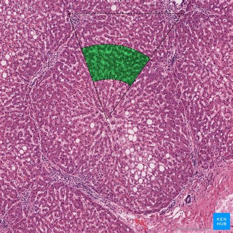 Liver Histology Structure Cells And Characteristics Kenhub Free Nude