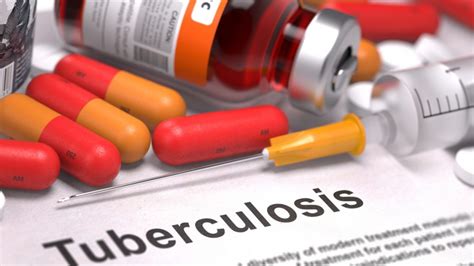 Nuevo Tratamiento Para La Tuberculosis Altamente Resistente