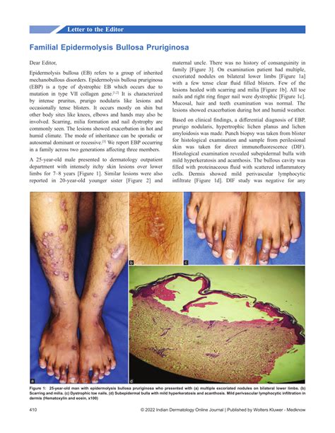 Pdf Familial Epidermolysis Bullosa Pruriginosa