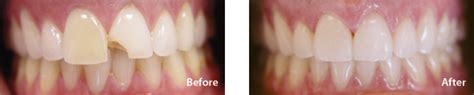 We have 2142 homeowner reviews of top houston carpet cleaning services. Cosmetic Dentist Houston | Veneers, Teeth Whitening ...