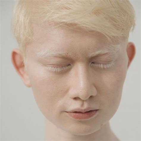 Imagens Que Mostram Toda A Beleza Do Albinismo
