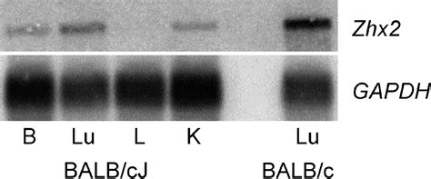 hereditary persistence of α fetoprotein and h19 expression in liver of balb cj mice is due to a