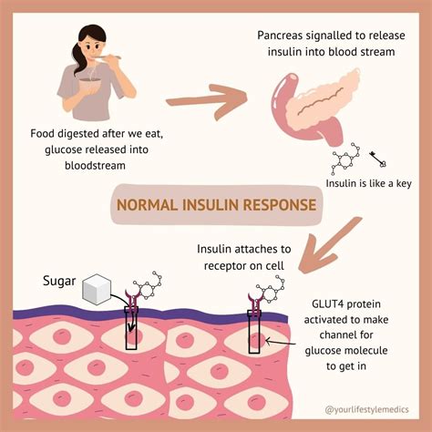 All You Need To Know About Insulin Resistance — Your Lifestyle Medics
